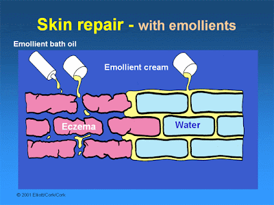 atopic dermatitis emollients