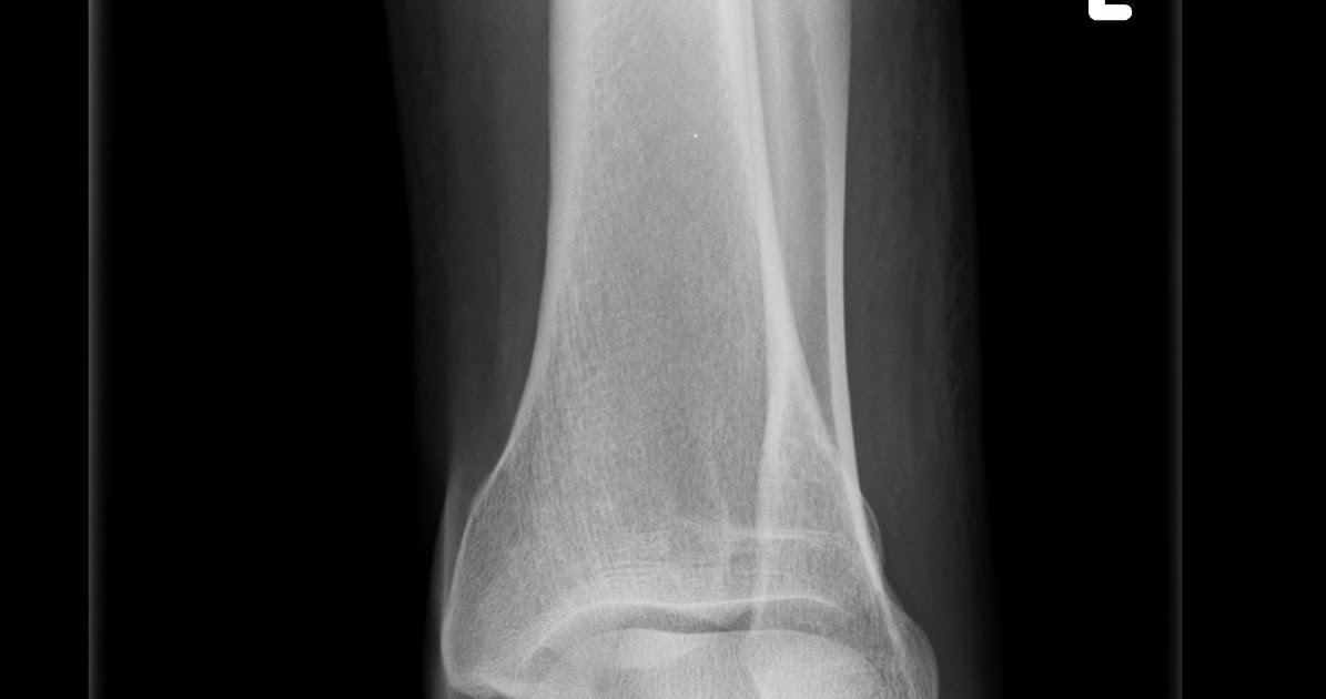 Een nieuwe dag Rontgenfoto Een nieuwe dag Rontgenfoto