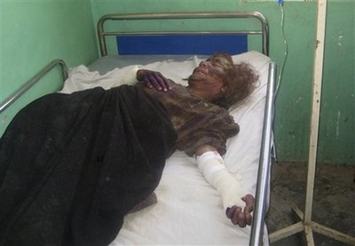 [injured_woman_us_air_strike.jpe]