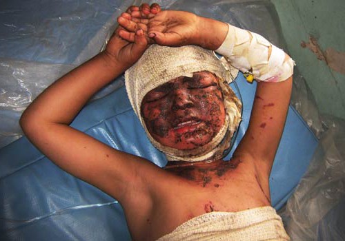 [wounded_bala_baluk_may5_2009.jpg]