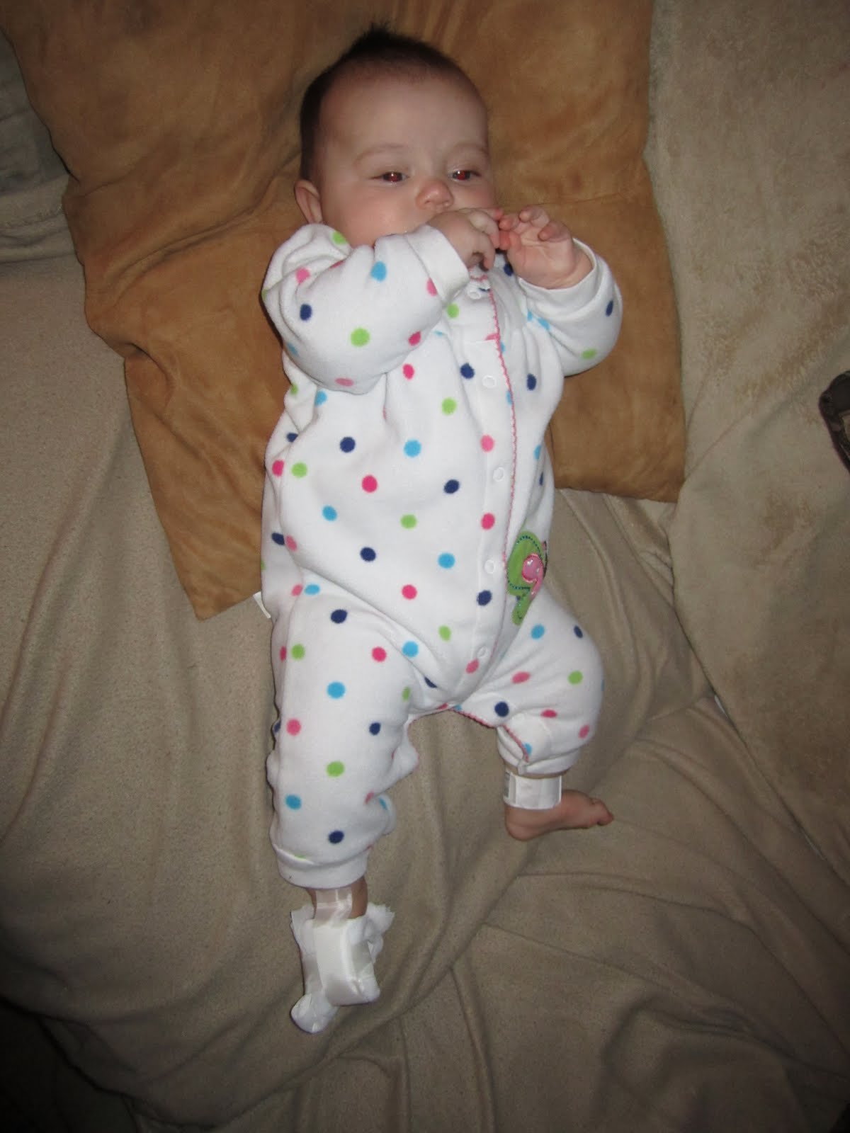 5 in 5 Bring on the Blessings! Diagnosis Hair tourniquet