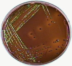 emb agar and e coli