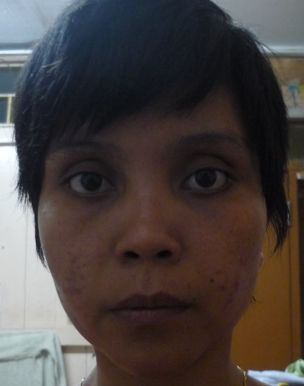 Ubat Semula Jadi Resdung  Notable f