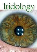 Iridology