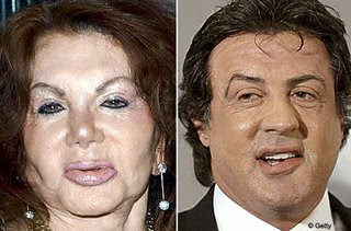Plastic & cosmetic surgery gone wrong 