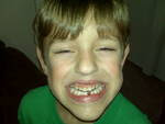 Grandson Austin, 1st Lost Tooth