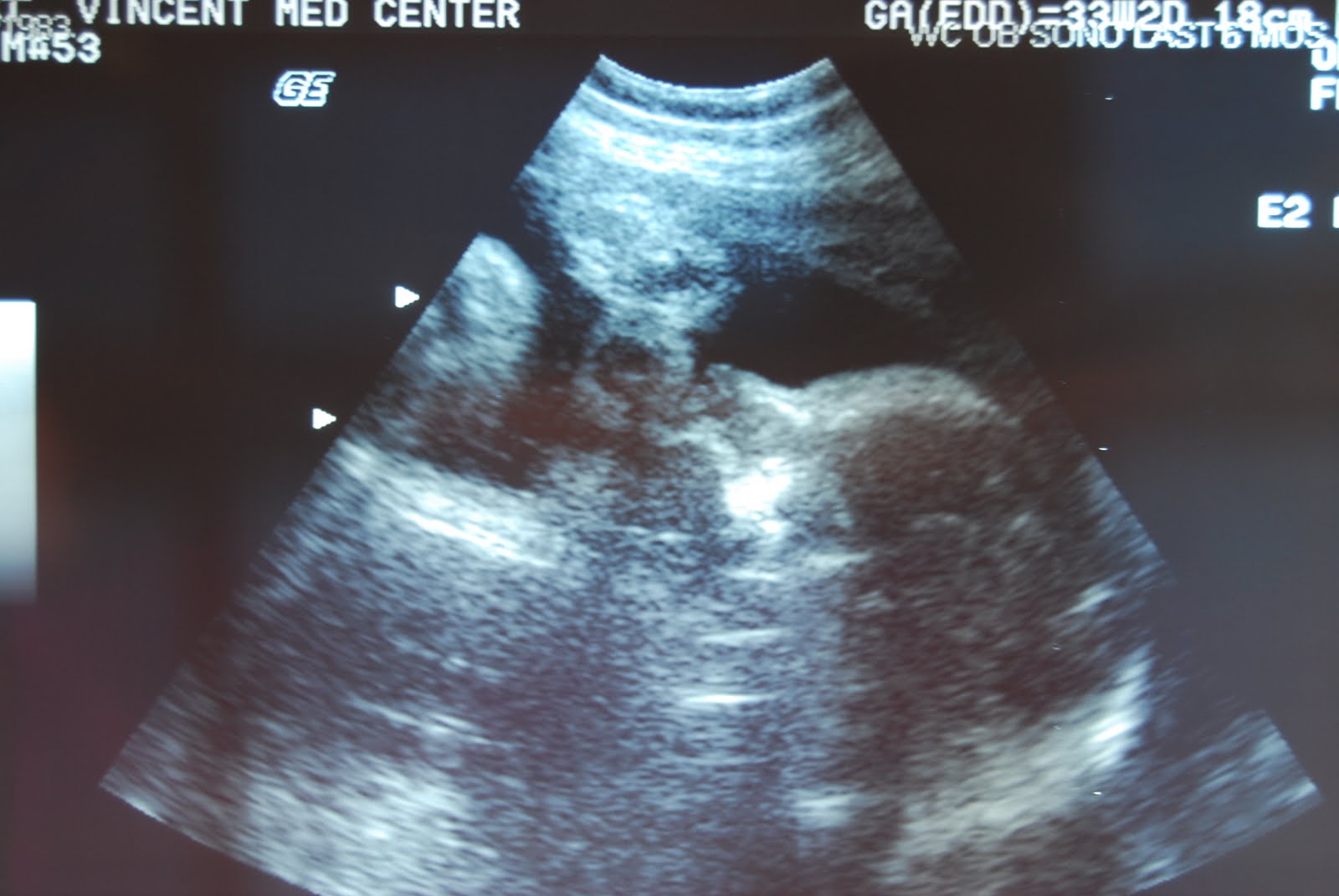 [March+2010+002.jpg]