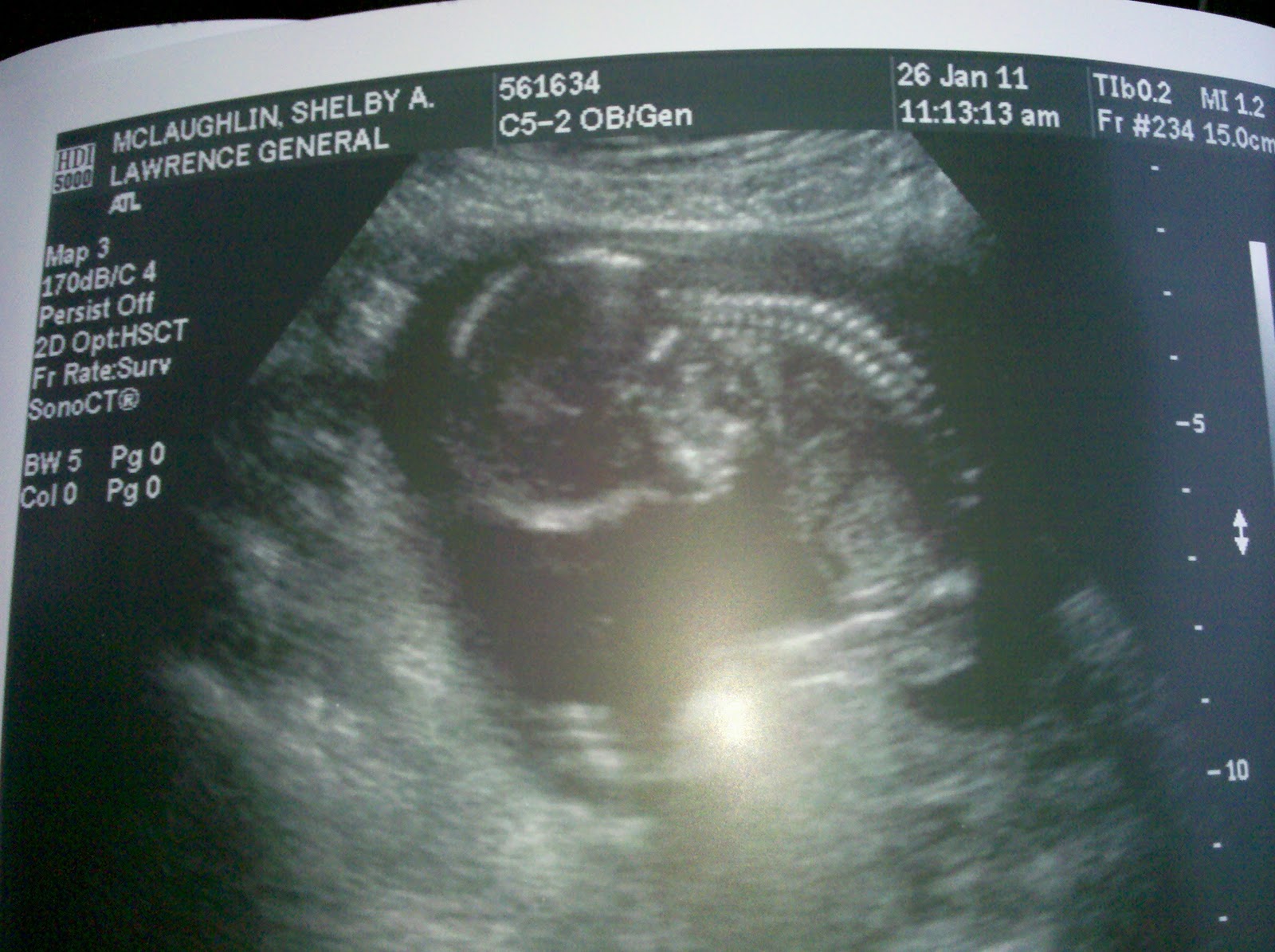 the-mclaughlin-family-15-weeks-5-days-ultrasound
