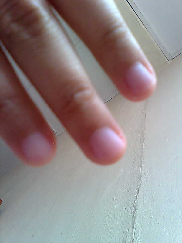 syafiqa_belle Discolored Nails Can Reflect Health