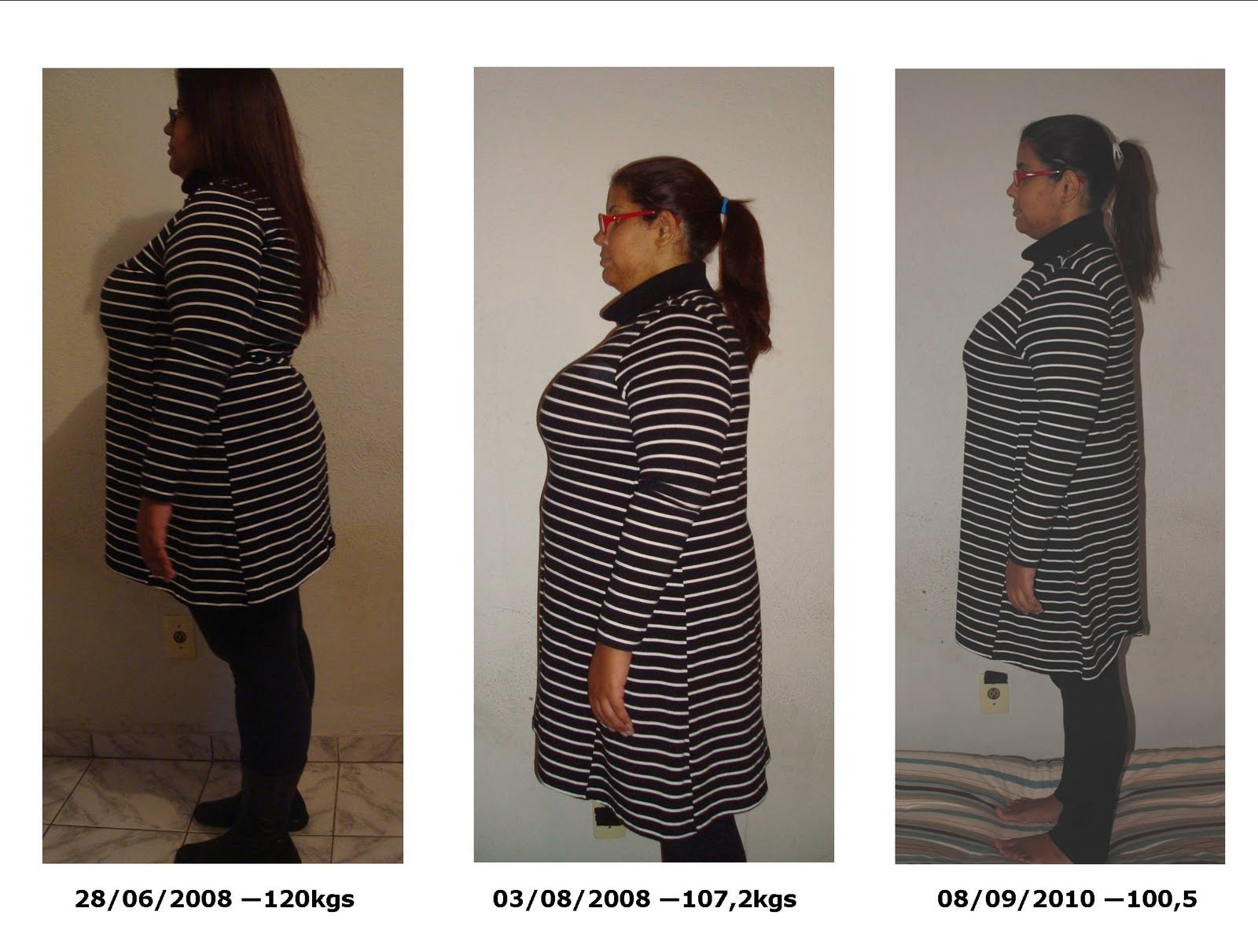 making-myself-better-irm-metralha-antes-e-depois