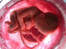 feto intrautero 2