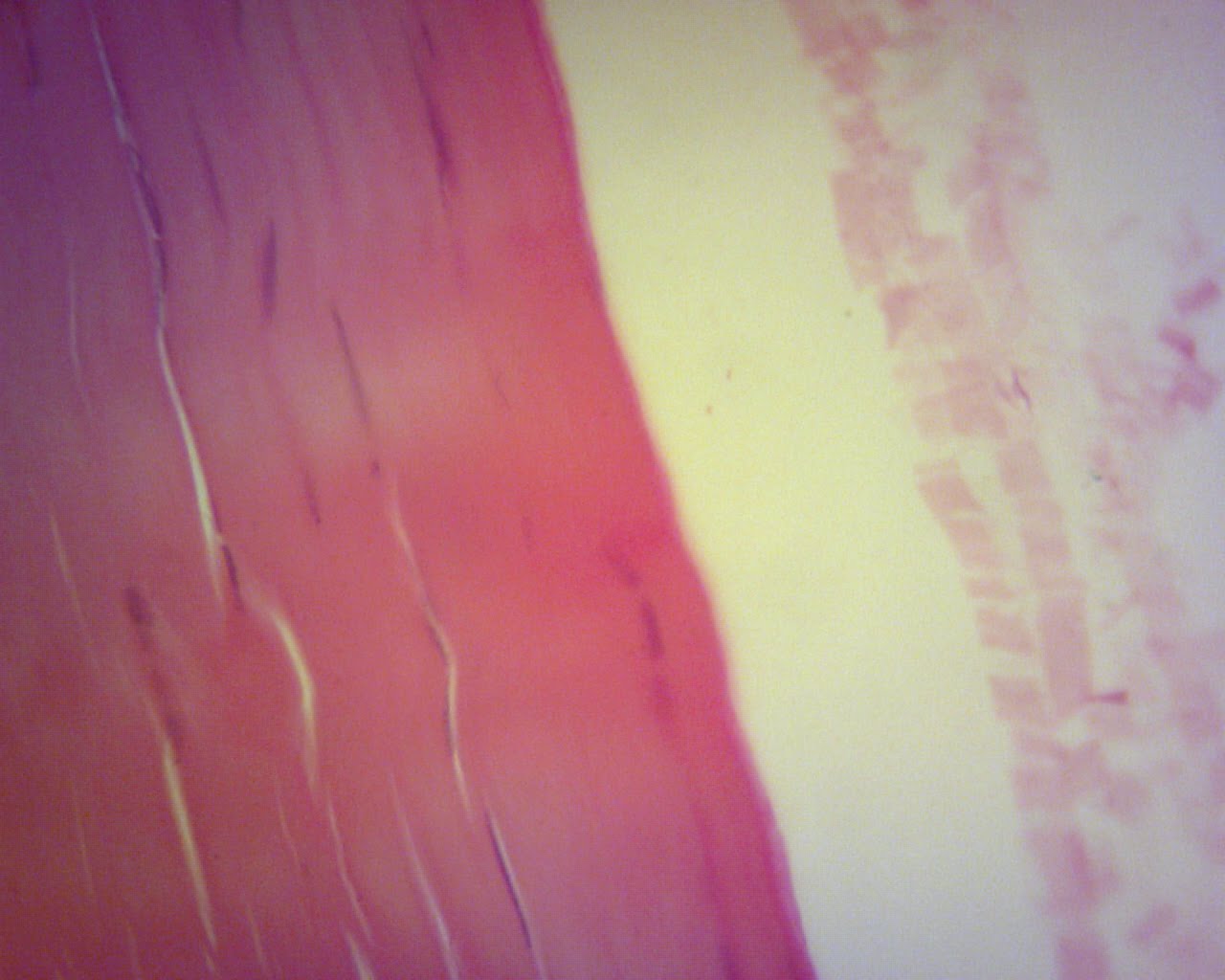 a flat fibrous sheet of connective tissue that attaches a muscle to a bone a flat fibrous sheet of connective tissue that attaches a muscle to a bone