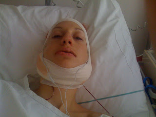 Nora Bernhard: kiefer-op