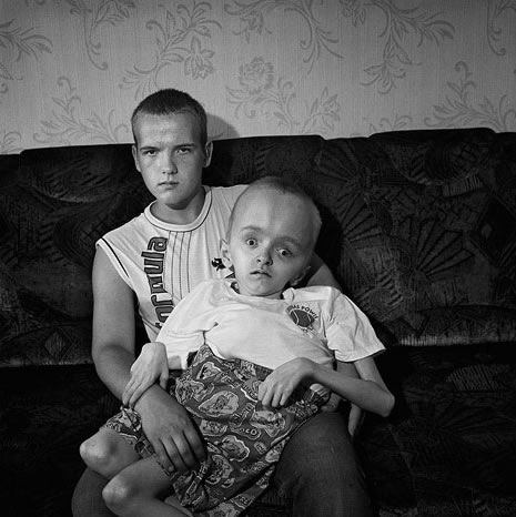 chernobyl-victims.jpg