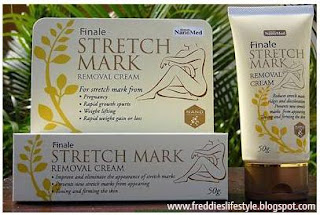 krim penyamar stretch mark