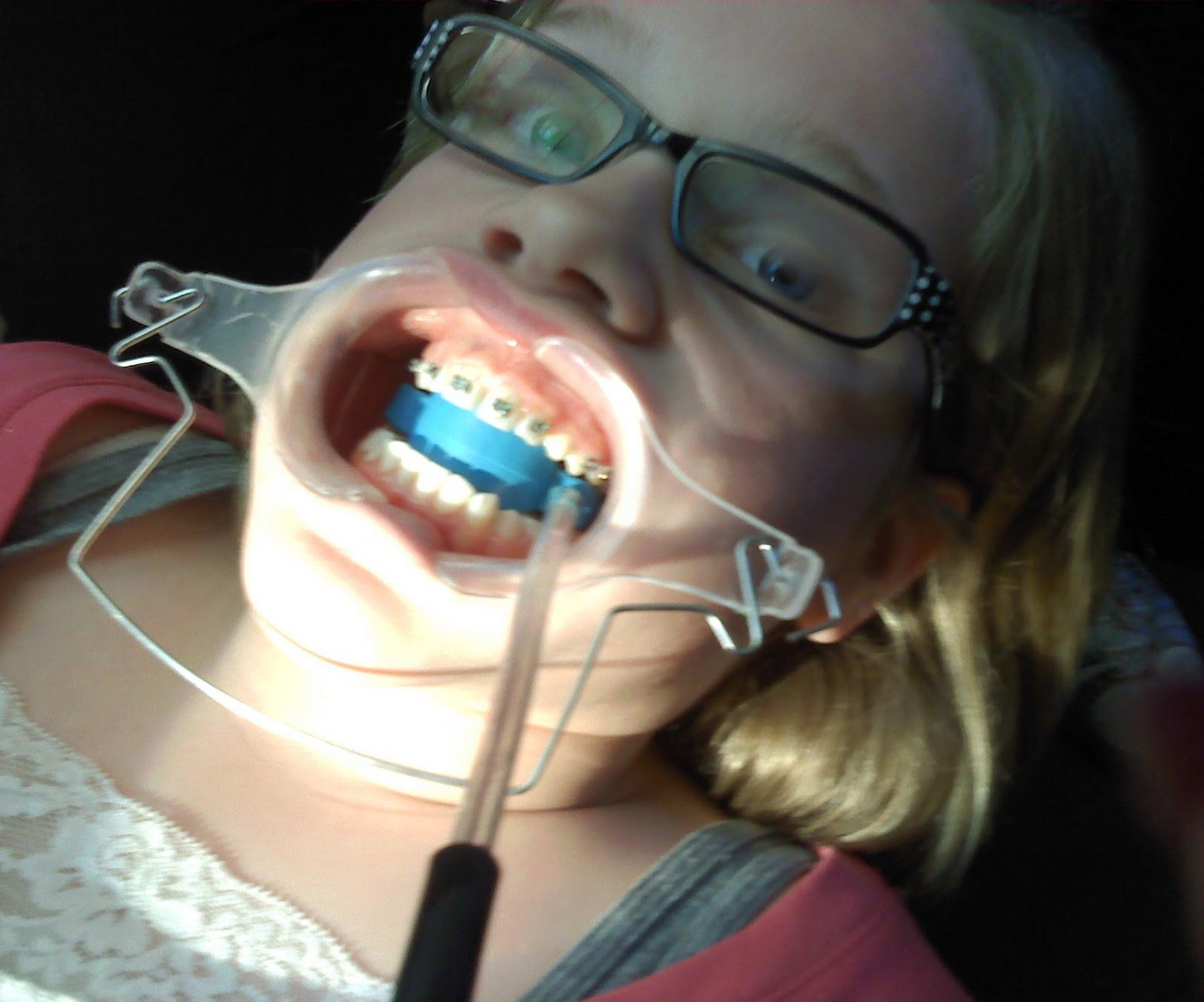 Pensive? No, Just Thinking Brace Yourselves!