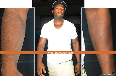 Top more than 76 50 cent removes tattoos best - in.cdgdbentre