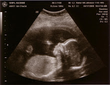 Brady (21 weeks)