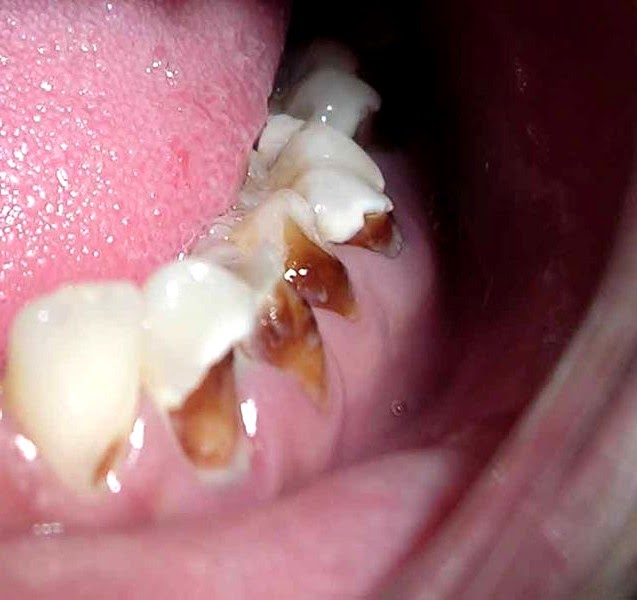 Soft drinks and health effects Health & Fitness Tips