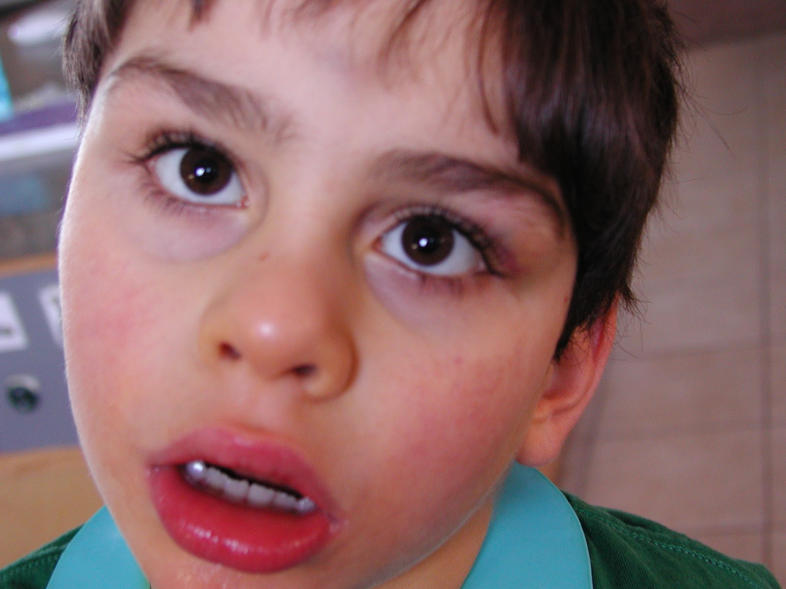 Boy Connected Okay, so now we're really starting CEASE...