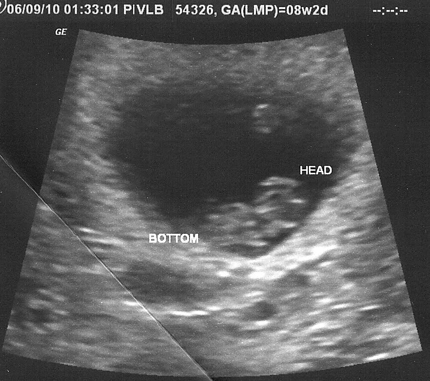 The Jumpers Sonograms are so much fun!