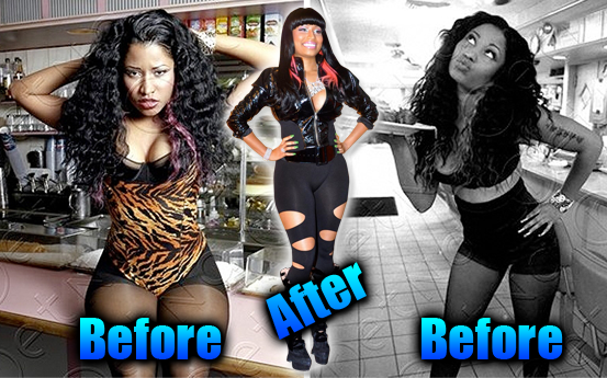 nicki minaj before and after surgery photos. Nicki Minaj Before The Plastic