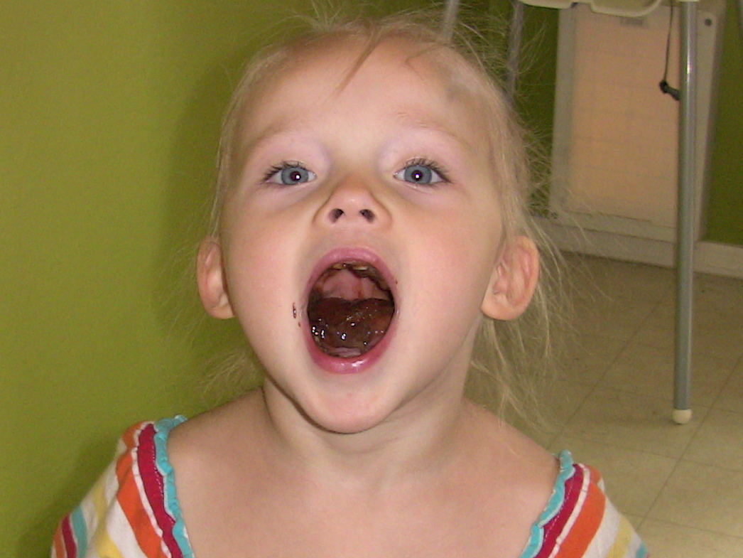 Ребенок с большим ртом. Дети открытый рот. Дети с открытыми ртами и слюнями. Открытый рот девочек. Девочка с открытым ртом.
