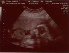 Me at 19 weeks along