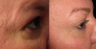 peter thomas roth eyelid lift serum