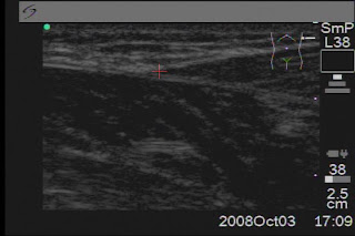 Labview & Matlab for PT: [Transcription] Superimposing line plots on image