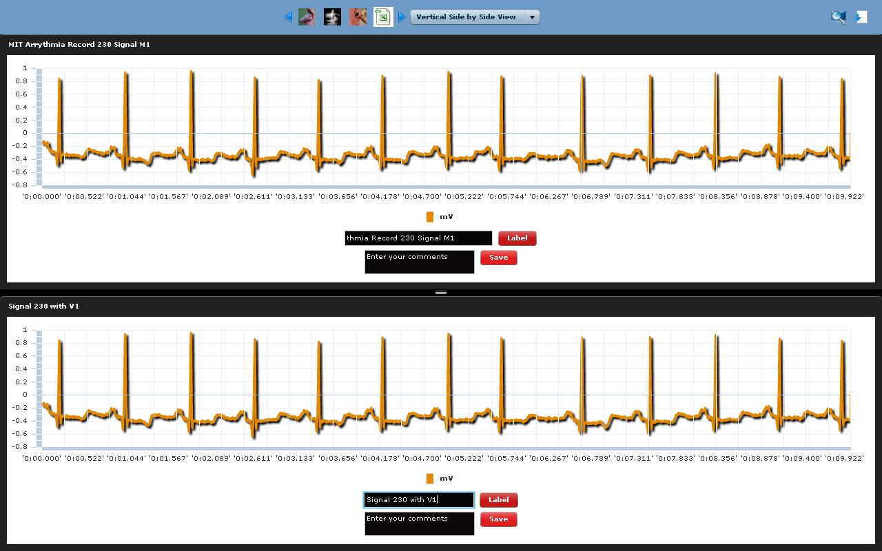 The Circle of Life: Physiological Data Visualization