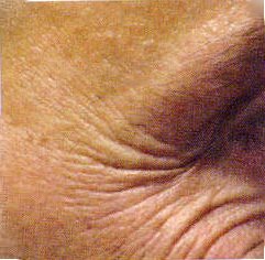 [kırışıklık+4.JPG]