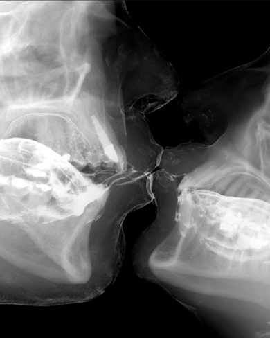 [XRAY+kissFINAL.jpg]