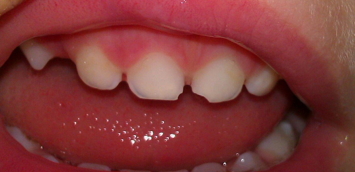 Ranger Paul Jones All I Want for Christmas Is NonChipped